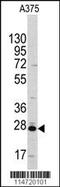 Chloride Intracellular Channel 1 antibody, 63-017, ProSci, Western Blot image 