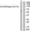 Vav Guanine Nucleotide Exchange Factor 3 antibody, TA326066, Origene, Western Blot image 