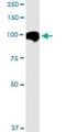 Microtubule Affinity Regulating Kinase 2 antibody, H00002011-M01, Novus Biologicals, Western Blot image 