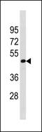 TATA-Box Binding Protein Associated Factor 7 Like antibody, PA5-49303, Invitrogen Antibodies, Western Blot image 