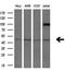 Activating Signal Cointegrator 1 Complex Subunit 1 antibody, M10024, Boster Biological Technology, Western Blot image 