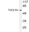 Transforming Growth Factor Beta Receptor 2 antibody, LS-C176560, Lifespan Biosciences, Western Blot image 