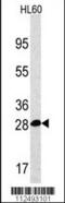 Proteasome Subunit Alpha 5 antibody, 57-770, ProSci, Western Blot image 