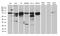 N6-adenosine-methyltransferase 70 kDa subunit antibody, M01758, Boster Biological Technology, Western Blot image 