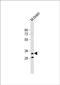 Transmembrane protein 106B antibody, PA5-72345, Invitrogen Antibodies, Western Blot image 