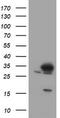 SRP Receptor Subunit Beta antibody, TA504725, Origene, Western Blot image 