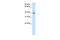 Integrin beta-1-binding protein 2 antibody, GTX47041, GeneTex, Western Blot image 