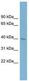 Alpha 1,4-Galactosyltransferase (P Blood Group) antibody, TA342030, Origene, Western Blot image 