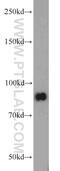 STAT3 antibody, 10253-2-AP, Proteintech Group, Western Blot image 