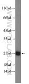 Protein Phosphatase 1 Regulatory Inhibitor Subunit 14D antibody, 22080-1-AP, Proteintech Group, Western Blot image 