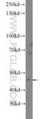 Astacin Like Metalloendopeptidase antibody, 21418-1-AP, Proteintech Group, Western Blot image 