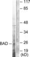 BCL2 Associated Agonist Of Cell Death antibody, abx015531, Abbexa, Western Blot image 