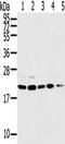 TPD52 Like 1 antibody, TA351838, Origene, Western Blot image 
