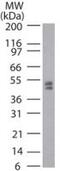 TRNA Aspartic Acid Methyltransferase 1 antibody, PA1-41105, Invitrogen Antibodies, Western Blot image 