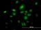 Septin 10 antibody, MA5-23101, Invitrogen Antibodies, Immunofluorescence image 