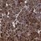 ATP Binding Cassette Subfamily F Member 2 antibody, NBP1-89318, Novus Biologicals, Immunohistochemistry frozen image 