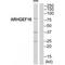 Rho Guanine Nucleotide Exchange Factor 16 antibody, A10332, Boster Biological Technology, Western Blot image 