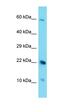 Coiled-Coil Domain Containing 149 antibody, orb326850, Biorbyt, Western Blot image 