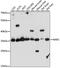 Nuclear Apoptosis Inducing Factor 1 antibody, GTX66346, GeneTex, Western Blot image 
