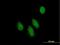 Nucleoporin 58 antibody, H00009818-B01P, Novus Biologicals, Immunocytochemistry image 