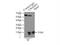 Cellular Retinoic Acid Binding Protein 2 antibody, 10225-1-AP, Proteintech Group, Immunoprecipitation image 