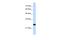 Transmembrane Protein 109 antibody, A14614, Boster Biological Technology, Western Blot image 