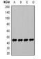 Phosphoglycerate Kinase 1 antibody, orb340803, Biorbyt, Western Blot image 