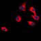 Stathmin 1 antibody, orb74844, Biorbyt, Immunofluorescence image 