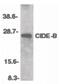 Cell Death Inducing DFFA Like Effector B antibody, PA5-19909, Invitrogen Antibodies, Western Blot image 