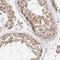 GCN1 antibody, NBP1-83381, Novus Biologicals, Immunohistochemistry paraffin image 