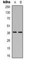 CD84 Molecule antibody, LS-C368962, Lifespan Biosciences, Western Blot image 
