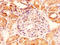 GLI Pathogenesis Related 1 antibody, LS-C285511, Lifespan Biosciences, Immunohistochemistry paraffin image 