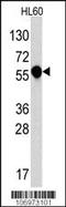 CD121a antibody, TA324837, Origene, Western Blot image 