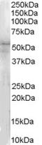 Interleukin 1 Receptor Associated Kinase 4 antibody, LS-B4823, Lifespan Biosciences, Western Blot image 