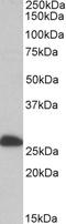 Electron Transfer Flavoprotein Subunit Beta antibody, EB10171, Everest Biotech, Western Blot image 