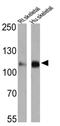 ATPase Sarcoplasmic/Endoplasmic Reticulum Ca2+ Transporting 2 antibody, MA3-910, Invitrogen Antibodies, Western Blot image 