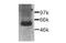 Cellular Communication Network Factor 2 antibody, PA1-22376, Invitrogen Antibodies, Western Blot image 