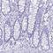 Cystatin D antibody, NBP2-31852, Novus Biologicals, Immunohistochemistry paraffin image 
