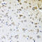 Carboxypeptidase A6 antibody, 15-125, ProSci, Immunohistochemistry paraffin image 