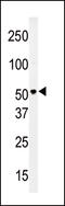 Solute Carrier Family 29 Member 4 antibody, 55-485, ProSci, Western Blot image 