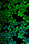 Twinkle protein, mitochondrial antibody, STJ27256, St John