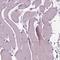 Growth Differentiation Factor 11 antibody, HPA069609, Atlas Antibodies, Immunohistochemistry frozen image 
