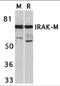 Interleukin 1 Receptor Associated Kinase 3 antibody, 2355, ProSci, Western Blot image 