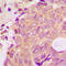 Arrestin Beta 1 antibody, LS-C358912, Lifespan Biosciences, Immunohistochemistry paraffin image 
