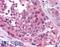 Melanoma-associated antigen 4 antibody, LS-B885, Lifespan Biosciences, Immunohistochemistry frozen image 