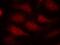 Cyclin Dependent Kinase 6 antibody, PA5-37518, Invitrogen Antibodies, Immunofluorescence image 