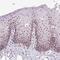 DExD-Box Helicase 50 antibody, NBP2-55077, Novus Biologicals, Immunohistochemistry paraffin image 
