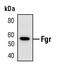 FGR Proto-Oncogene, Src Family Tyrosine Kinase antibody, PA5-17413, Invitrogen Antibodies, Western Blot image 