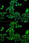 Flavin Containing Dimethylaniline Monoxygenase 3 antibody, GTX55626, GeneTex, Immunocytochemistry image 