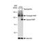 Poly(ADP-Ribose) Polymerase 1 antibody, GTX09509, GeneTex, Western Blot image 
